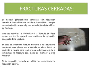FRACTURAS CERRADAS
El manejo generalmente comienza con reducción
cerrada e inmovilización, se debe inmovilizar siempre
una articulación proximal y una articulación distal al foco
de fractura.
Una vez reducida e inmovilizada la fractura se debe
tomar una Rx de control para confirmar la reducción
adecuada de la fractura.
En caso de tener una fractura inestable o no sea posible
mantener una alineación adecuada se debe llevar al
paciente a cirugía para realizar una reducción abierta e
inmovilizar la fractura con pines de Kirshner u otro
material.
Si la reducción cerrada es fallida se recomienda la
reducción abierta.
 