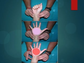 APARATO FLEXOR :
 Flexor común profundo de
los dedos
 Flexores superficiales:
Movilidad: Lesión tendinosa
 
