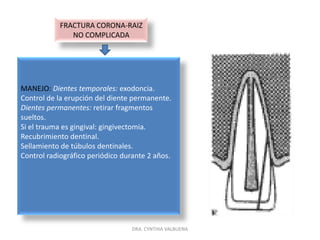 FRACTURA CORONAL COMPLICADAMANEJO: prescripción de analgésicos.Evaluar tamaño, tiempo de exposición y compromiso pulpar.Valorar la necesidad de terapia física: frio y calor.Dientes temporales: pulpotomia o tratamiento convencional de endodoncia.Control radiográfico cada 3 a 6 meses.Dientes permanentes: recubrimiento pulpar directo.APEXOGENESIS: según vitalidad y tiempo transcurrido.Control radiográfico durante 5 años.DRA. CYNTHIA VALBUENA