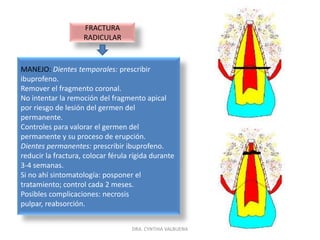 FRACTURA CORONA-RAIZ COMPLICADASIGNOS:  fractura del esmalte dentina y cemento con exposición pulpar.Movilidad dental.SÍNTOMAS:dolor.MANEJO:dientes temporales: exodoncia.Control de la erupción del diente permanente.Dientes permanentes: antibioticoterapia.Prescripción de analgésicos.Retirar fragmentos.Hacer gingivectomia.Pulpotomia o tratamiento convencional de endodoncia.Tracción ortodoncia.Rehabilitación.Control radiográfico cada 6 meses durante 5 años.DRA. CYNTHIA VALBUENA