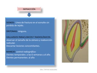CLASIFICACIÓN DE LAS  FRACTURASFRACTURASFRACTURA RADICULARFRACTURA CORONO-RADICULARInfracción Fractura corona-raiz no complicadaFractura coronal no complicadaFractura coronal complicadaFractura corona-raiz complicadaDRA. CYNTHIA VALBUENA