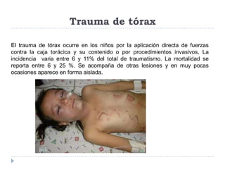 Trauma de tórax
El trauma de tórax ocurre en los niños por la aplicación directa de fuerzas
contra la caja torácica y su contenido o por procedimientos invasivos. La
incidencia varia entre 6 y 11% del total de traumatismo. La mortalidad se
reporta entre 6 y 25 %. Se acompaña de otras lesiones y en muy pocas
ocasiones aparece en forma aislada.

 