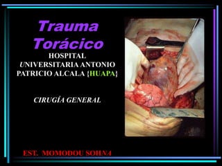 Trauma
Torácico
HOSPITAL
UNIVERSITARIA ANTONIO
PATRICIO ALCALA {HUAPA}
CIRUGÍA GENERAL
EST. MOMODOU SOHNA
 