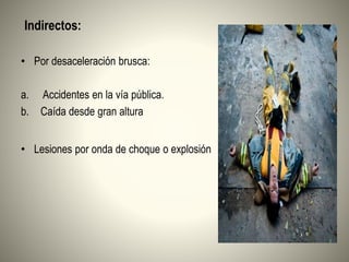 Indirectos:
• Por desaceleración brusca:
a. Accidentes en la vía pública.
b. Caída desde gran altura
• Lesiones por onda de choque o explosión
 