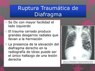 Ruptura Traumática de
Diafragma
 Se Dx con mayor facilidad el
lado izquierdo
 El trauma cerrado produce
grandes desgarros radiales que
llevan a la herniación
 La presencia de la elevación del
diafragma derecho en la
radiografía de tórax puede ser
el único hallazgo de una lesión
derecha
 