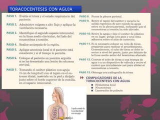 TORACOCENTESIS CON AGUJA
 