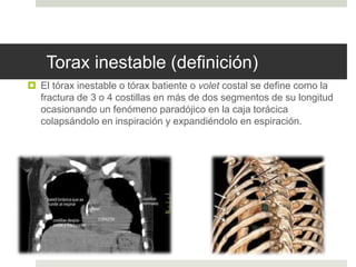 Trauma de torax | PPT