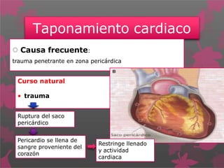 Taponamiento cardiaco
 Causa frecuente:
trauma penetrante en zona pericárdica
Curso natural
• trauma
Ruptura del saco
pericárdico
Pericardio se llena de
sangre proveniente del
corazón
Restringe llenado
y actividad
cardiaca
 