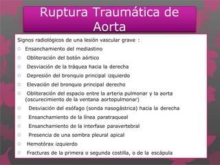 Ruptura Traumática de
Aorta
Signos radiológicos de una lesión vascular grave :
 Ensanchamiento del mediastino
 Obliteración del botón aórtico
 Desviación de la tráquea hacia la derecha
 Depresión del bronquio principal izquierdo
 Elevación del bronquio principal derecho
 Obliteración del espacio entre la arteria pulmonar y la aorta
(oscurecimiento de la ventana aortopulmonar)
 Desviación del esófago (sonda nasogástrica) hacia la derecha
 Ensanchamiento de la línea paratraqueal
 Ensanchamiento de la interfase paravertebral
 Presencia de una sombra pleural apical
 Hemotórax izquierdo
 Fracturas de la primera o segunda costilla, o de la escápula
 