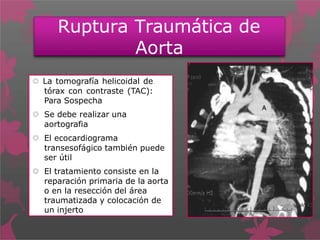 Ruptura Traumática de
Aorta
 La tomografía helicoidal de
tórax con contraste (TAC):
Para Sospecha
 Se debe realizar una
aortografia
 El ecocardiograma
transesofágico también puede
ser útil
 El tratamiento consiste en la
reparación primaria de la aorta
o en la resección del área
traumatizada y colocación de
un injerto
 