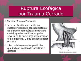Ruptura Esofágica
por Trauma Cerrado
 Común: Trauma Pentrante
 debe ser tenida en cuenta en
cualquier paciente con neumotórax
izquierdo o hemotórax sin fractura
costal, que ha recibido un golpe
severo en la parte baja del esternón
o el epigastrio, y que presenta dolor
o shock
 tubo torácico muestra partículas
que indican contenido intestinal o
gástrico
 