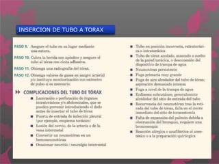 INSERCION DE TUBO A TORAX
 