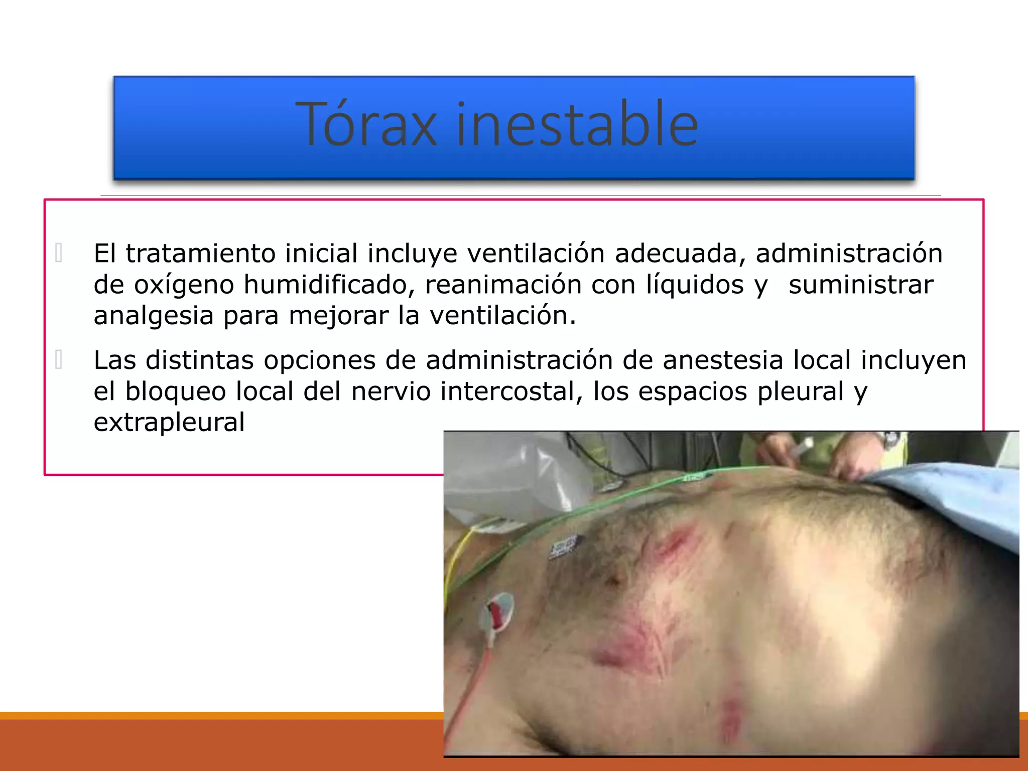 Trauma de torax | PPTX