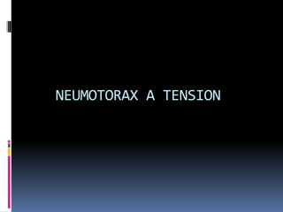 NEUMOTORAX A TENSION
 