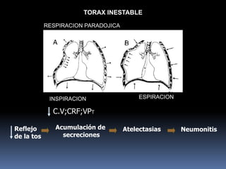 TORAX INESTABLE
RESPIRACION PARADOJICA
INSPIRACION ESPIRACION
C.V;CRF;VPT
Reflejo
de la tos
Acumulación de
secreciones
Atelectasias Neumonitis
 