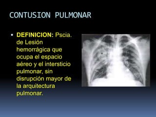 CONTUSION PULMONAR
 DEFINICION: Pscia.
de Lesión
hemorrágica que
ocupa el espacio
aéreo y el intersticio
pulmonar, sin
disrupción mayor de
la arquitectura
pulmonar.
 