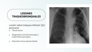 Lesión sobre tráquea inferior( 75%
pericaria)
● Fitsula aérea
● Diagnostico con broncoscopio y
tratamiento quirúrgico.
● Descartar rotura parcial silente
LESIONES
TRAQUEOBRONQUIALES
 