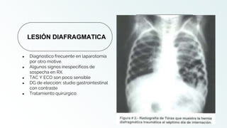 ● Diagnostico frecuente en laparotomía
por otro motive.
● Algunos signos inespecificos de
sospecha en RX.
● TAC Y ECO son poco sensible
● DG de elección: studio gastrointestinal
con contraste
● Tratamiento quirúrgico.
LESIÓN DIAFRAGMATICA
 