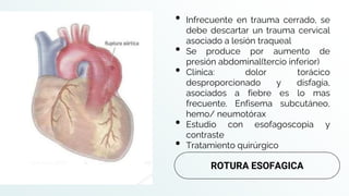 • Infrecuente en trauma cerrado, se
debe descartar un trauma cervical
asociado a lesión traqueal
• Se produce por aumento de
presión abdominal(tercio inferior)
• Clínica: dolor torácico
desproporcionado y disfagia,
asociados a fiebre es lo mas
frecuente. Enfisema subcutáneo,
hemo/ neumotórax
• Estudio con esofagoscopia y
contraste
• Tratamiento quirúrgico
ROTURA ESOFAGICA
 