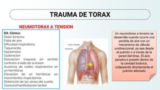 DX. Clinico:
Dolor toracico
Falta de aire
Dificultad respiratoria
Taquicardia
hipotension
Sudoracion
Desviacion traqueal en sentido
contrario a lado de la lesion
Ausencia de ruidos respiratorios en
un hemitórax
Elevación de un hemitórax sin
movimientos respiratorios.
Distención de las venas del cuello
Cianosis(manifestación tardía)
TRAUMA DE TORAX
NEUMOTORAX A TENSION
Un neumotórax a tensión se
desarrolla cuando ocurre una
perdida de aire con un
mecanismo de válvula
unidireccional, ya sea desde
el pulmón o a través de la
pared del tórax. El aire
penetra a presión dentro de
la cavidad torácica,
colapsando directamente el
pulmón afectado
 