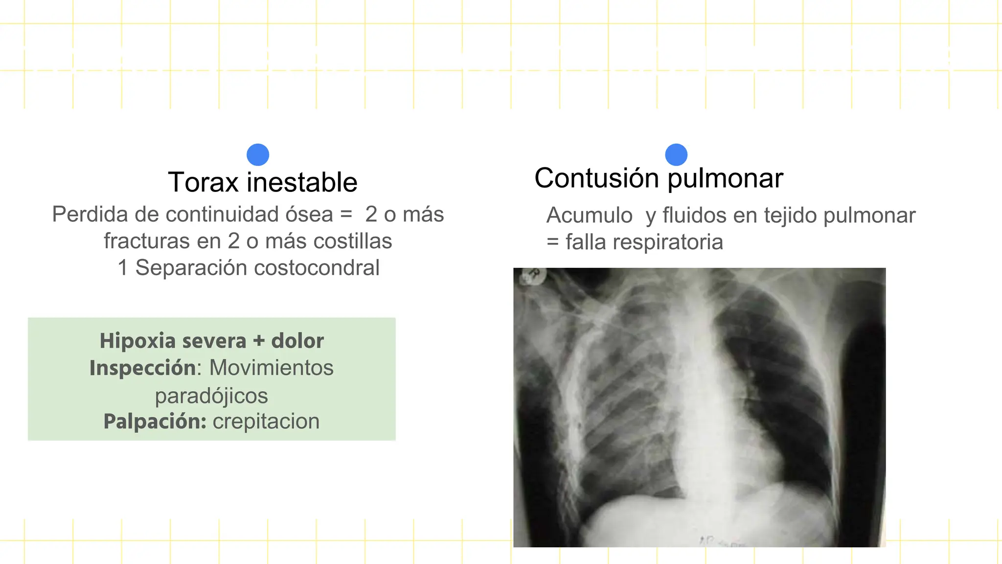 Torax Inestable Rx Trauma de torax; Neumotorax a tension, taponamiento cardiaco, por ...
