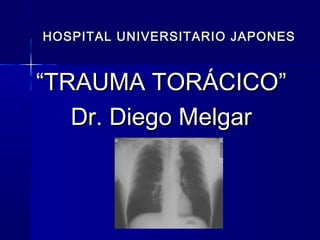 HOSPITAL UNIVERSITARIO JAPONESHOSPITAL UNIVERSITARIO JAPONES
““TRAUMA TORÁCICO”TRAUMA TORÁCICO”
Dr. Diego MelgarDr. Diego Melgar
 
