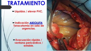 TRATAMIENTO
Líquidos / elevar PVC.
Indicación ABSOLUTA
Toracotomía en sala de
urgencias.
Evacuación rápida /
ventana pericárdica /
estable.
 