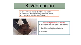 B. Ventilación
 Exposición completa del tórax y el cuello
 Valoración de respiración y venas del cuello
 Collar cervical con apertura anterior
Signos importantes de trauma
• Aumento de la frecuencia respiratoria
• Cambio movilidad respiratoria
• Cianosis
 