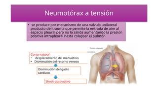 Neumotórax a tensión
• se produce por mecanismo de una válvula unilateral
producto del trauma que permite la entrada de aire al
espacio pleural pero no la salida aumentando la presión
positiva intrapleural hasta colapsar el pulmón
Curso natural
• desplazamiento del mediastino
• Disminución del retorno venoso
Disminución del gasto
cardiaco
Shock obstructivo
 
