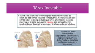 Tórax Inestable
• Trauma relacionado con múltiples fracturas costales, es
decir, de dos o más costillas consecutivas fracturadas en dos
o más sitios lo que produce que un segmento del tórax se
mueva por si solo, aunque la hipoxia sea generalmente
producida por la respiración superficial causada por el dolor
La palpación de los
movimientos
respiratorios- anormales y la
crepitación proveniente
de las fracturas costales o
cartílagos ayudan en el
diagnóstico
 