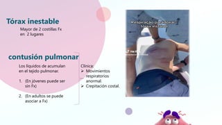 (trauma de torax)Presentación Dr Varela.pptx