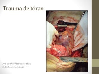 Dra. Juana Vásquez Rodas
Medico Residente de Cirugía
Trauma de tórax
 