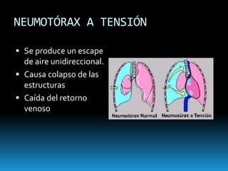 ABC… DE LA REANIMACIÓNA: Vía aérea con control de la columna cervical.B: Ventilación y oxigenación.C: Tratamiento del shock y control de la hemorragia.D: Rápida valoración neurológica.E: Exposición total del paciente con control de la hipotermia.