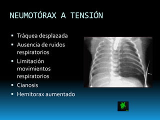 LESIONES RÁPIDAMENTE LETALESPOTENCIALMENTE LETALESObstrucción de vía aéreaNeumotórax a tensiónNeumotórax abiertoHemotórax masivoTórax inestableTaponamiento cardiacoContusión pulmonarRuptura aórticaRuptura traqueobronquialRuptura de esófagoRuptura del diafragmaContusión miocárdica
