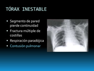 NEUMOTÓRAX ABIERTOVendaje oclusivoTubo de tórax: lejos de herida inicial