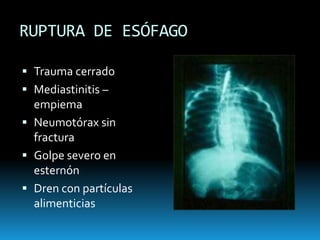 VALORACIÓN SECUNDARIA