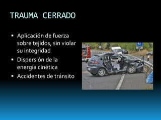 TRAUMA CERRADOAplicación de fuerza sobre tejidos, sin violar su integridadDispersión de la energía cinéticaAccidentes de tránsito