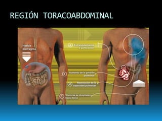 REGIÓN TORACOABDOMINAL