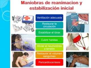 Ventilación adecuada
Restaurar la
circulación
Estabilizar el tórax
Cubrir heridas
Aliviar el neumotórax
a tensión
Restaurar el volumen
sanguíneo
Pericardiocentesis
 