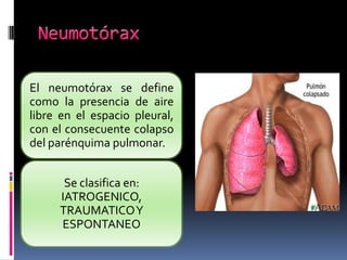 El neumotórax se define
como la presencia de aire
libre en el espacio pleural,
con el consecuente colapso
del parénquima pulmonar.
Se clasifica en:
IATROGENICO,
TRAUMATICOY
ESPONTANEO
 