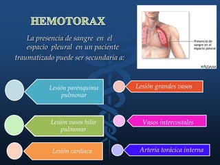 La presencia de sangre en el
espacio pleural en un paciente
traumatizado puede ser secundaria a:
Lesión parénquima
pulmonar
Lesión vasos hilio
pulmonar
Lesión cardiaca
Lesión grandes vasos
Vasos intercostales
Arteria torácica interna
 