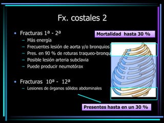 Fx. costales 2
• Fracturas 1ª - 2ª
– Más energía
– Frecuentes lesión de aorta y/o bronquios
– Pres. en 90 % de roturas traqueo-bronquiales
– Posible lesión arteria subclavia
– Puede producir neumotórax
• Fracturas 10ª - 12ª
– Lesiones de órganos sólidos abdominales
Mortalidad hasta 30 %
Presentes hasta en un 30 %
 