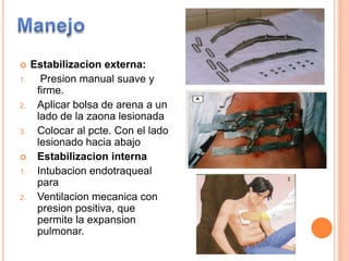  Estabilizacion externa:
1. Presion manual suave y
firme.
2. Aplicar bolsa de arena a un
lado de la zaona lesionada
3. Colocar al pcte. Con el lado
lesionado hacia abajo
 Estabilizacion interna
1. Intubacion endotraqueal
para
2. Ventilacion mecanica con
presion positiva, que
permite la expansion
pulmonar.
 