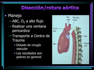 • Manejo
– ABC, O2 a alto flujo
– Realizar una ventana
pericardica
– Transporte a Centro de
Trauma
• Dotado de cirugía
vascular
• Los resultados son
pobres en general
 