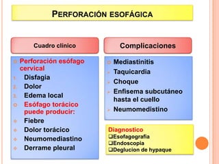 PERFORACIÓN ESOFÁGICA
 Perforación esófago
cervical
1. Disfagia
2. Dolor
3. Edema local
 Esófago torácico
puede producir:
 Fiebre
 Dolor torácico
 Neumomediastino
 Derrame pleural
 Mediastinitis
 Taquicardia
 Choque
 Enfisema subcutáneo
hasta el cuello
 Neumomedistino
Cuadro clínico Complicaciones
Diagnostico
Esofagografia
Endoscopia
Deglucion de hypaque
 
