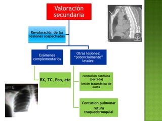 Valoración
secundaria
Exámenes
complementarios
RX, TC, Eco, etc
Otras lesiones:
“potencialmente”
letales:
contusión cardia...