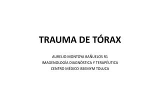 TRAUMA DE TÓRAX
AURELIO MONTOYA BAÑUELOS R1
IMAGENOLOGÍA DIAGNÓSTICA Y TERAPÉUTICA
CENTRO MÉDICO ISSEMYM TOLUCA
 