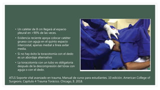 • Un catéter de 8 cm llegará al espacio
pleural en >90% de las veces.
• Evidencia reciente apoya colocar catéter
grueso con aguja en el quinto espacio
intercostal, apenas medial a línea axilar
media.
• Si no hay éxito la toracotomía con el dedo
es un abordaje alternativo
• La toracotomía con un tubo es obligatoria
después de la descompresión del tórax con
aguja o con el dedo.
ATLS Soporte vital avanzado en trauma, Manual de curso para estudiantes. 10 edición. American College of
Surgeons. Capítulo 4 Trauma Torácico. Chicago, Il. 2018.
 