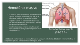 Hemotórax masivo
• Se produce por la acumulación rápida de más de
1500 mL de sangre o de un tercio o más de la
volemia del paciente en la cavidad torácica.
• Sospecha cuando se asocia estado de choque
con la ausencia de ruidos respiratorios o matidez
a la percusión en hemitórax.
• Inicialmente se trata en forma simultánea con
restitución de volumen y la descompresión de la
cavidad torácica.
Tubo torácico simple
(28-32 Fr)
ATLS Soporte vital avanzado en trauma, Manual de curso para estudiantes. 10 edición. American College of
Surgeons. Capítulo 4 Trauma Torácico. Chicago, Il. 2018.
 
