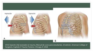 ATLS Soporte vital avanzado en trauma, Manual de curso para estudiantes. 10 edición. American College of
Surgeons. Capítulo 4 Trauma Torácico. Chicago, Il. 2018.
 